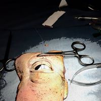 CORSO DI CHIRURGIA OFTALMICA AVANZATA 